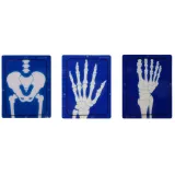 Zabawka lekarz z turkusową aparaturą i akcesoriami do badania